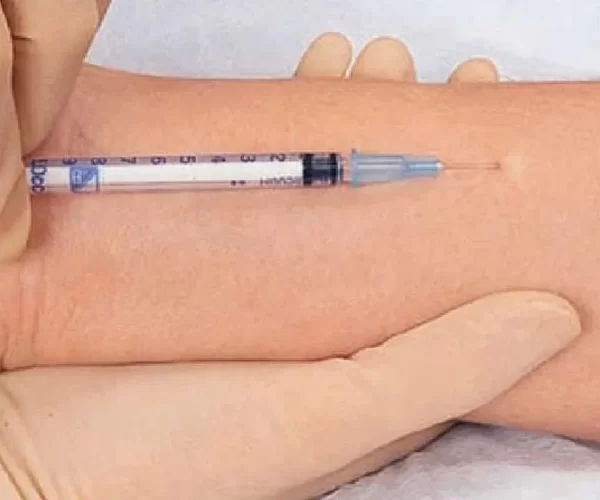 Subcutaneous Injections 2